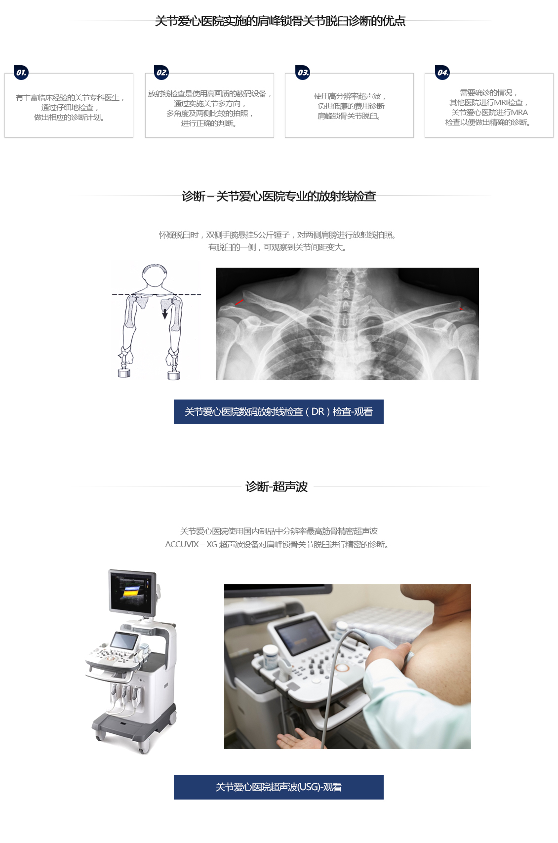 견봉쇄골 관절 탈구