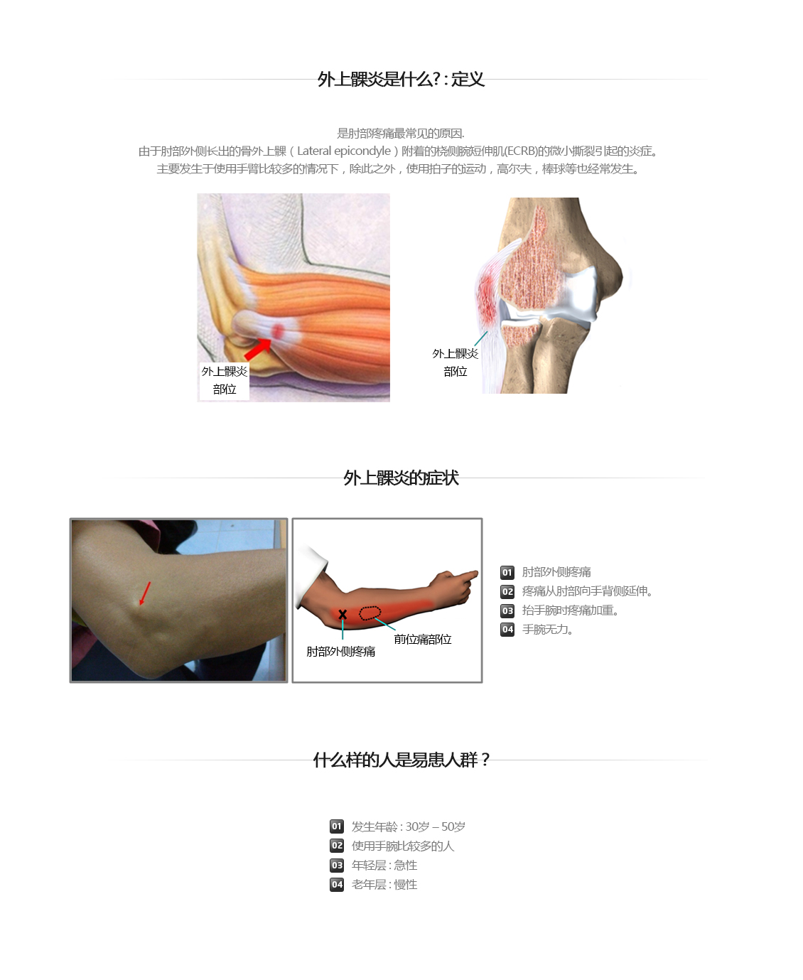 팔꿈치 증상별 진단 