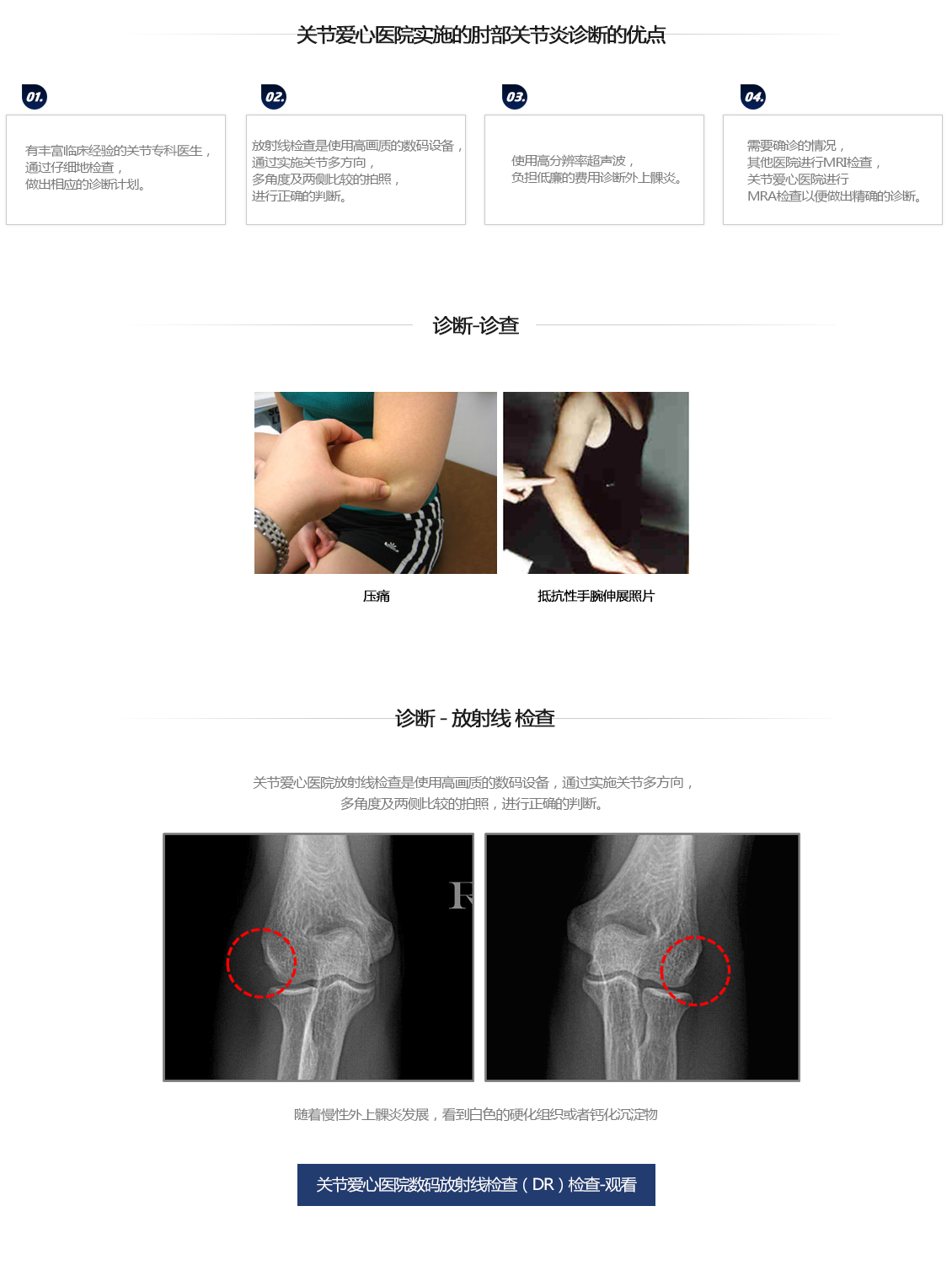 팔꿈치 증상별 진단 