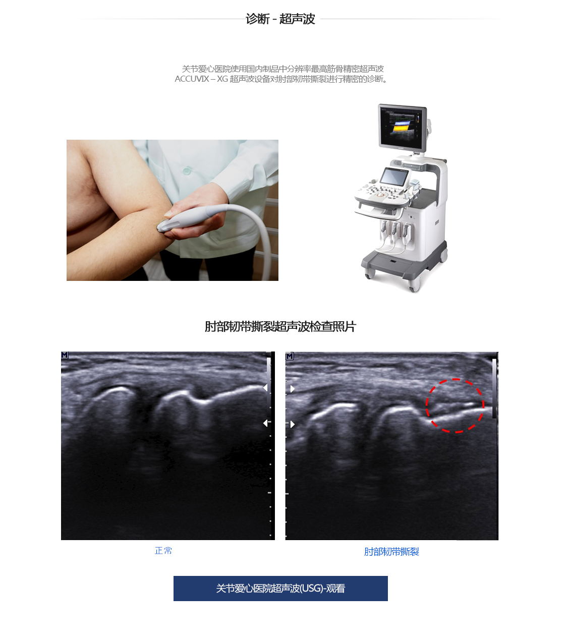 팔꿈치 증상별 진단 