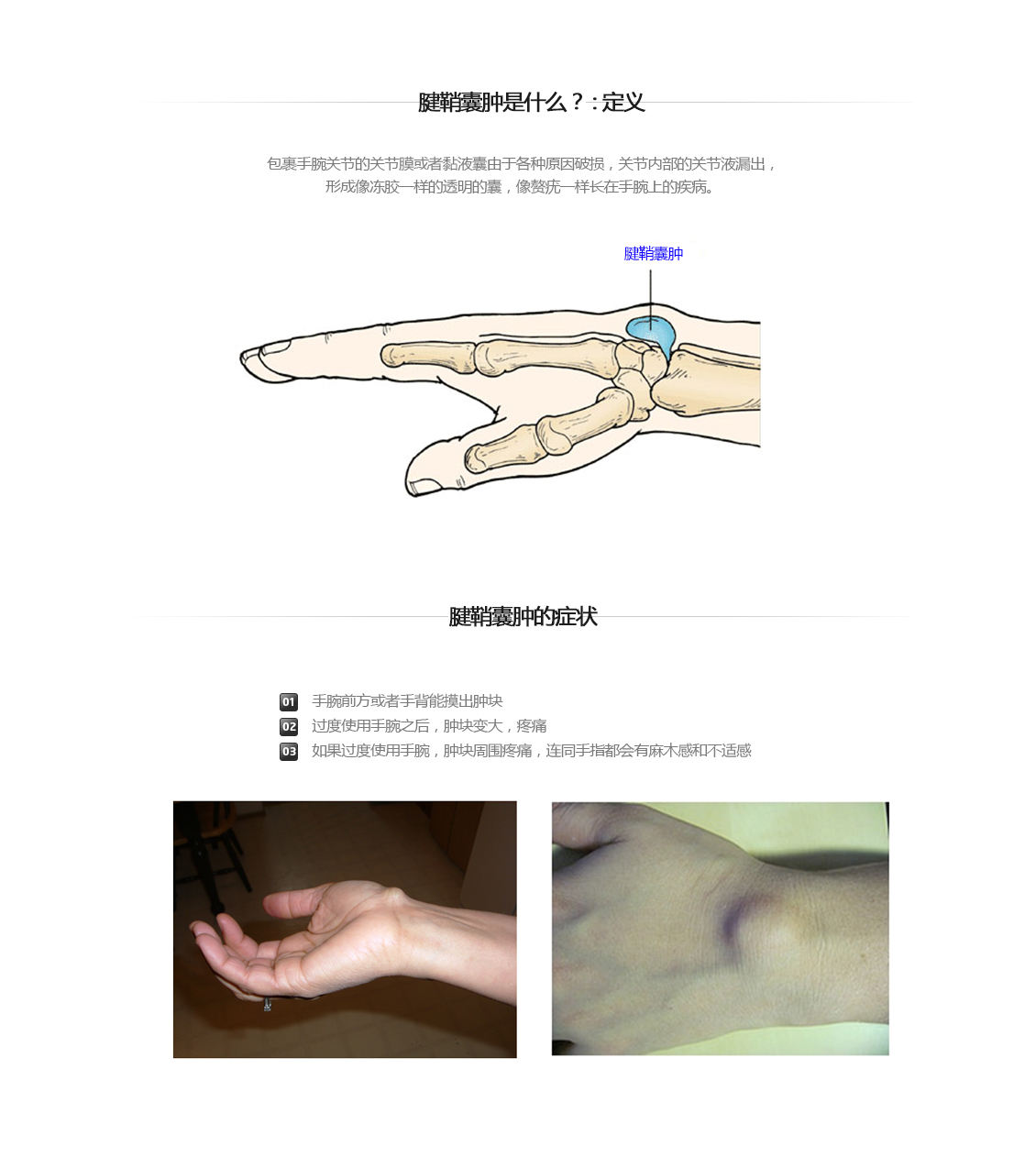 손목 증상별 진단 