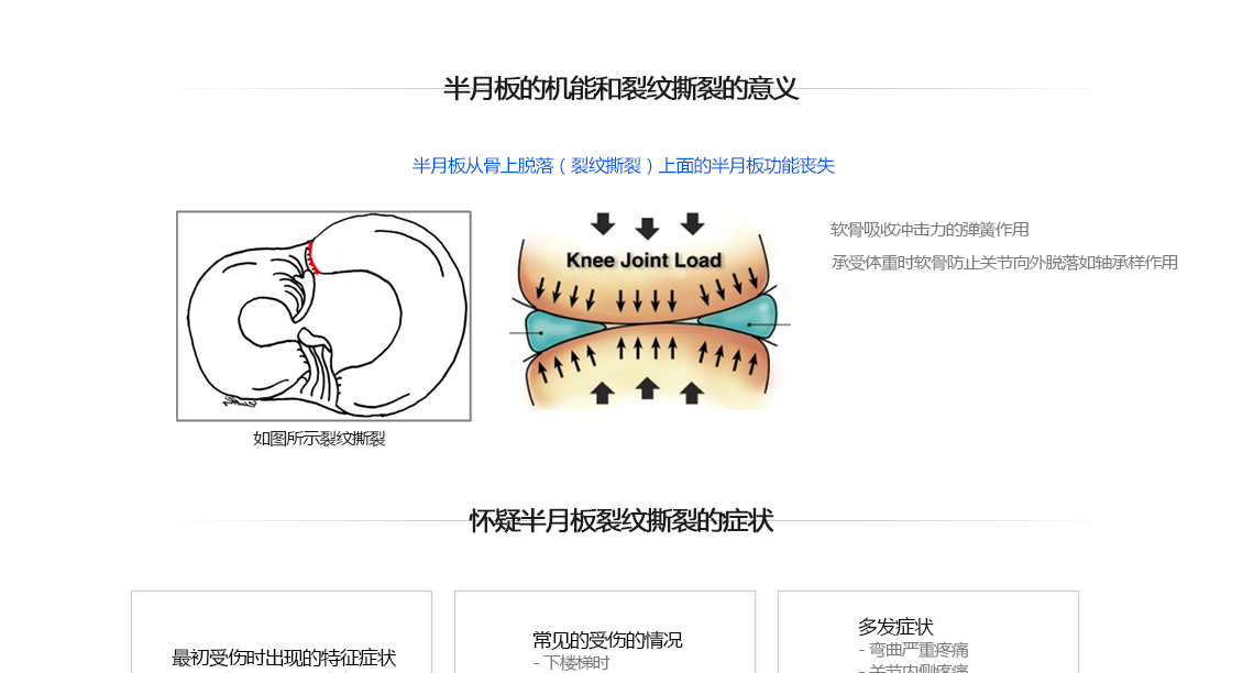 반월상연골 견열파열