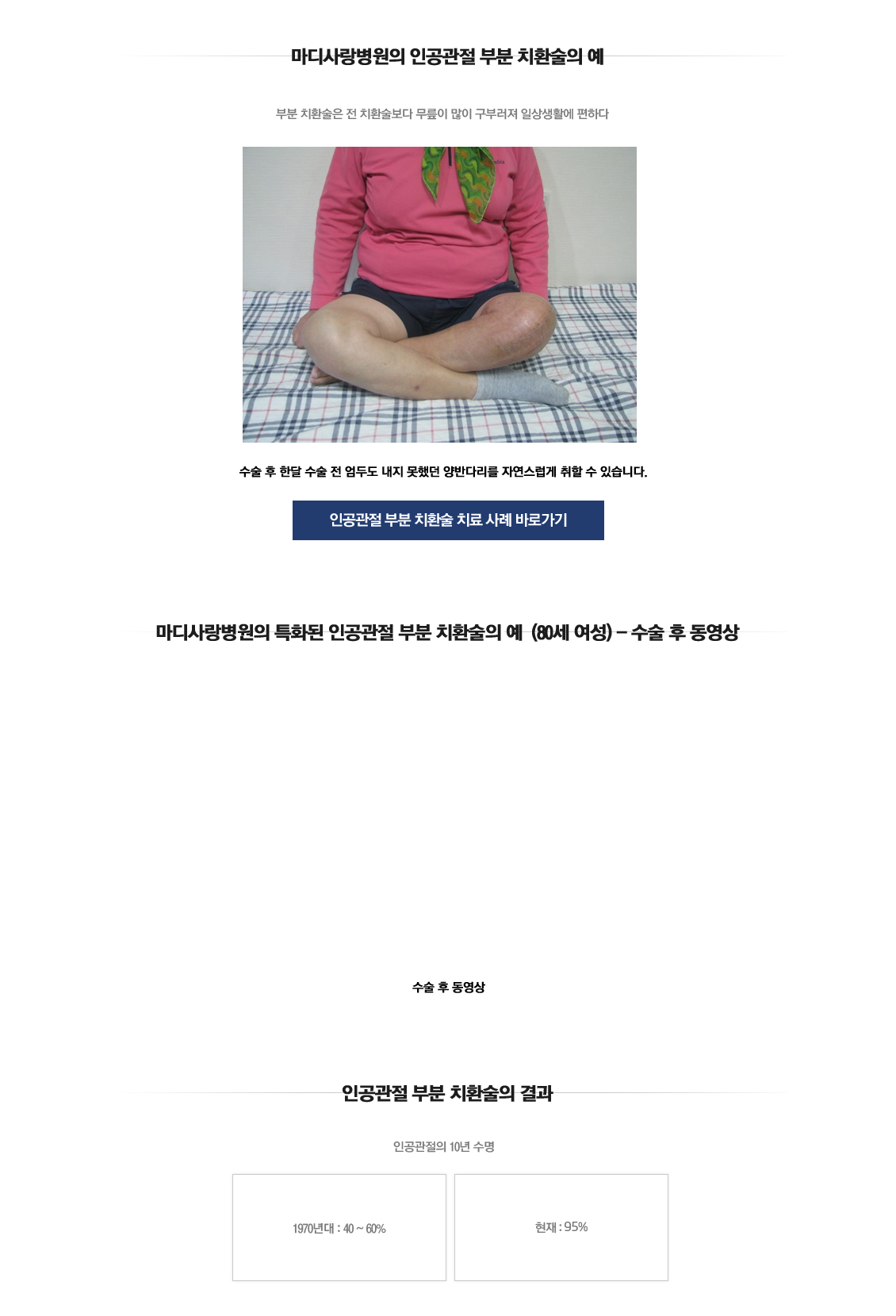 인공관절 부분치환술