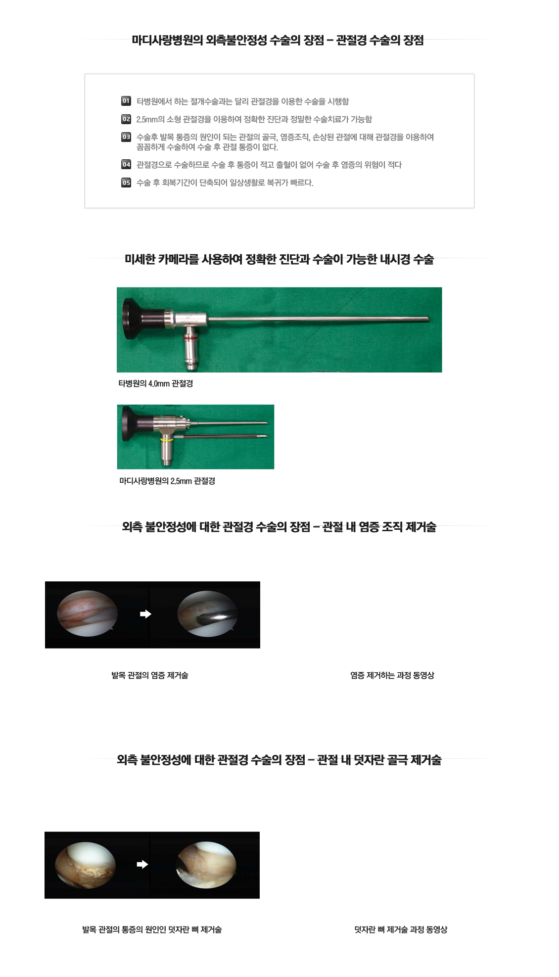 외측불안정성 수술