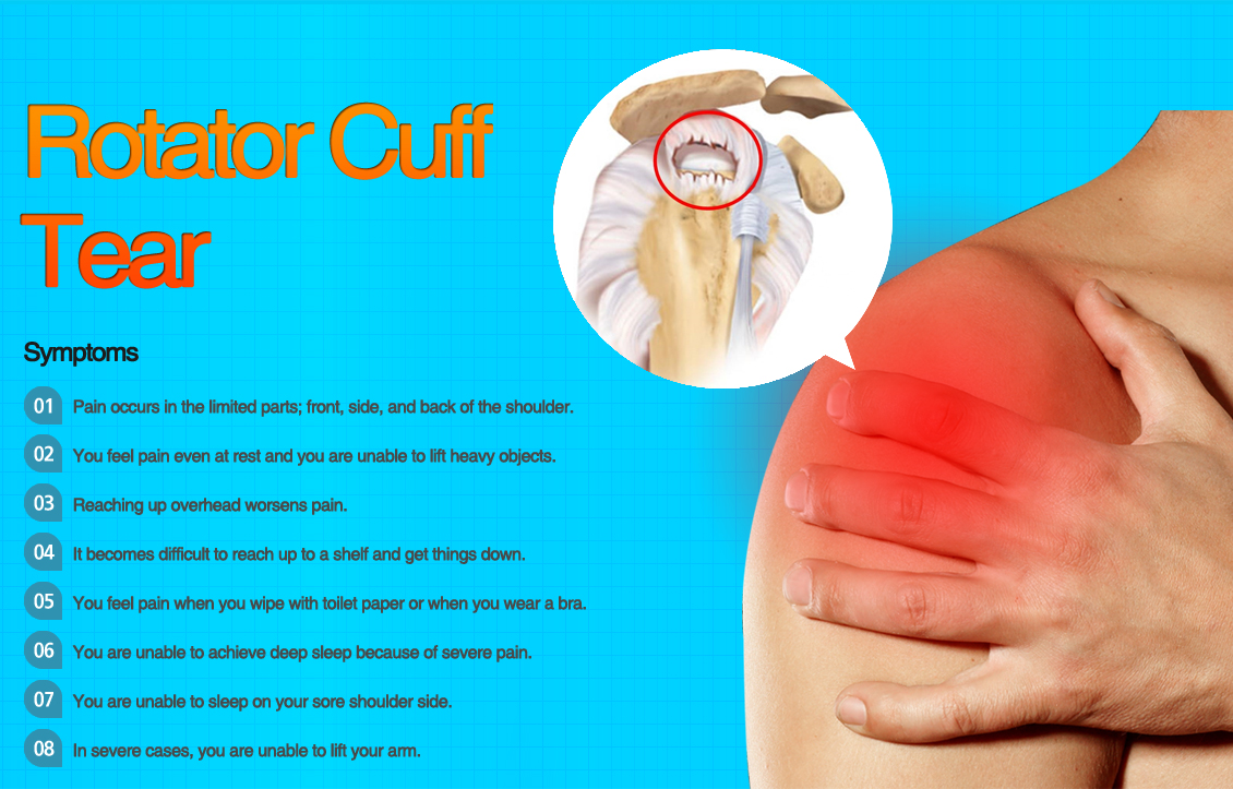 Rotator cuff tear