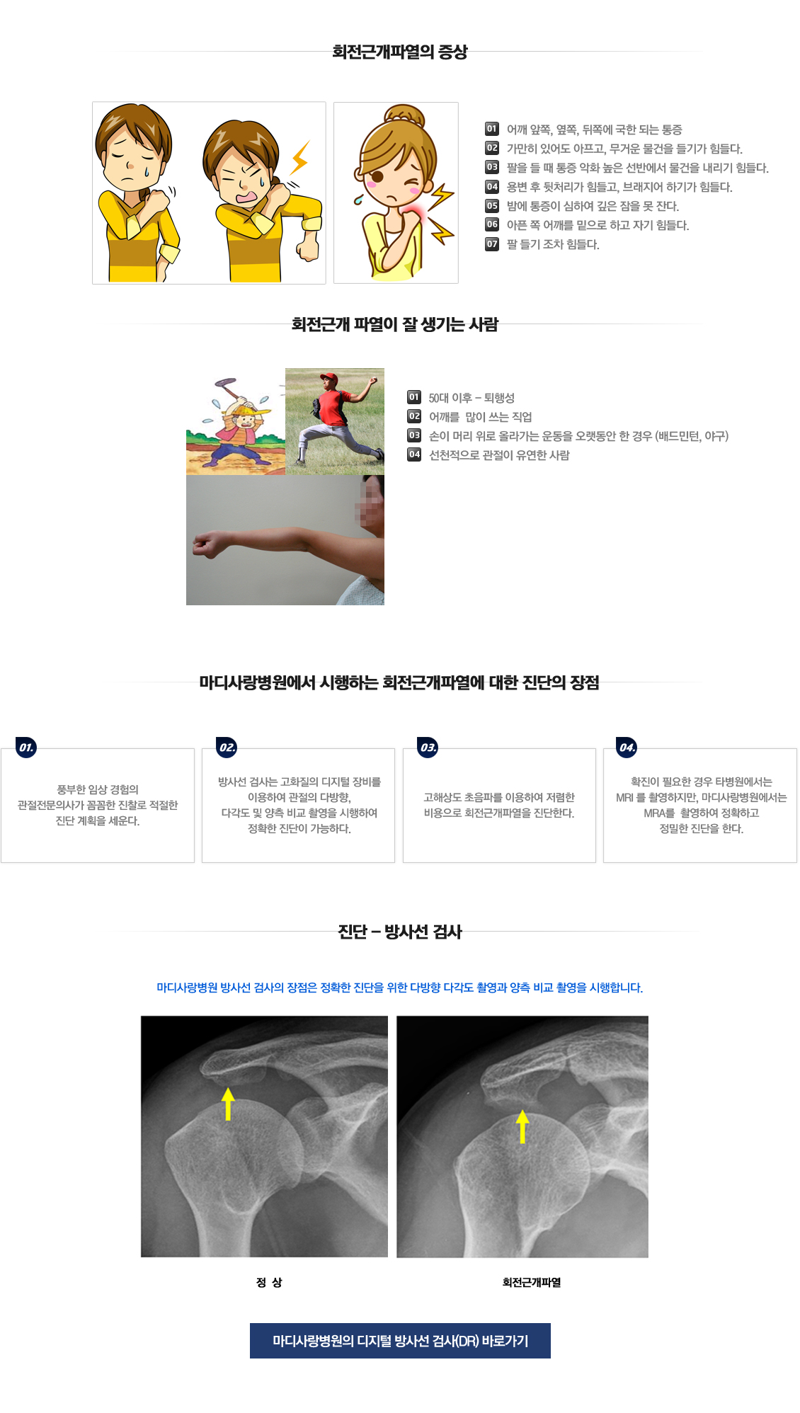 Rotator cuff tear