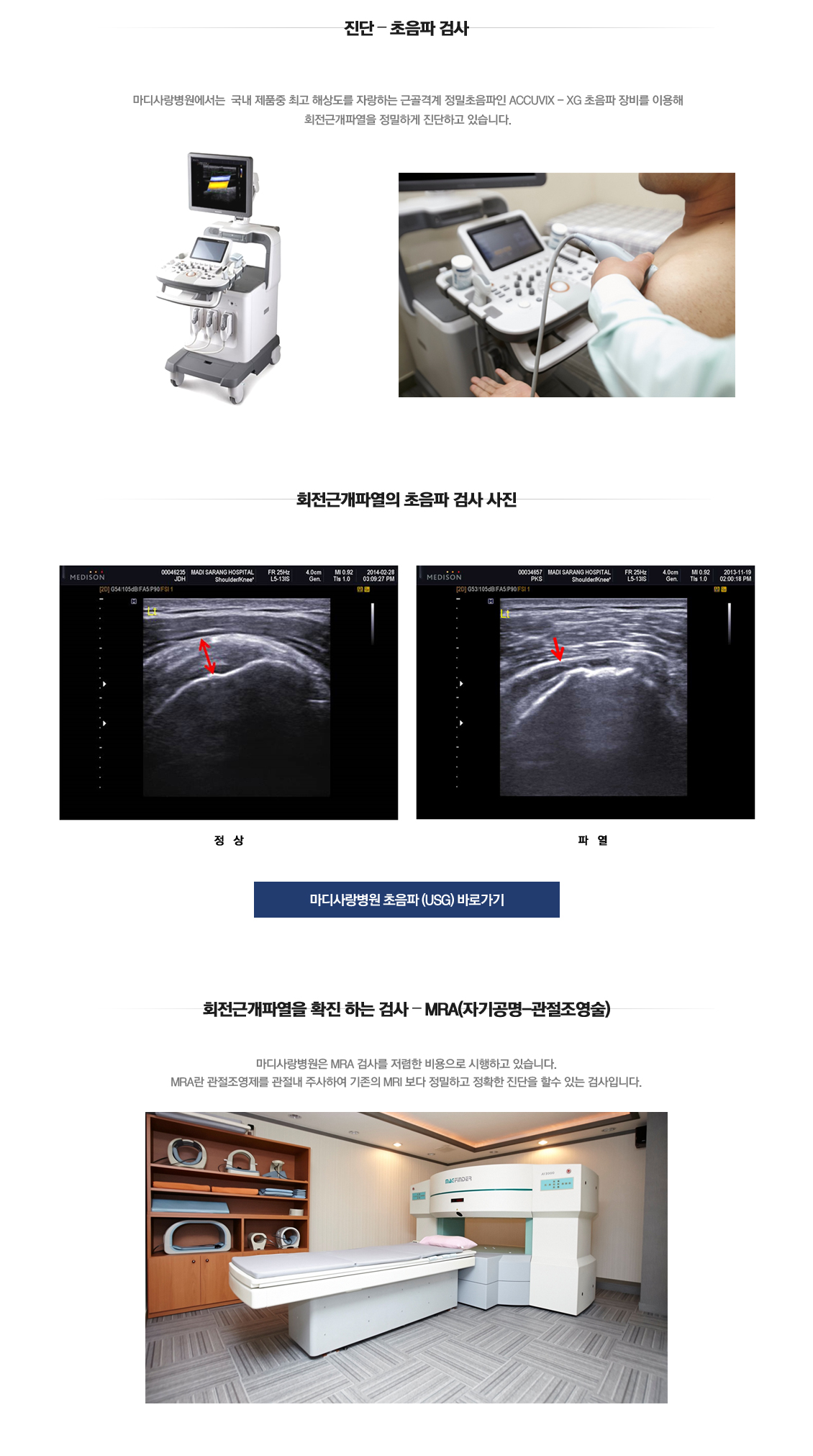 Rotator cuff tear