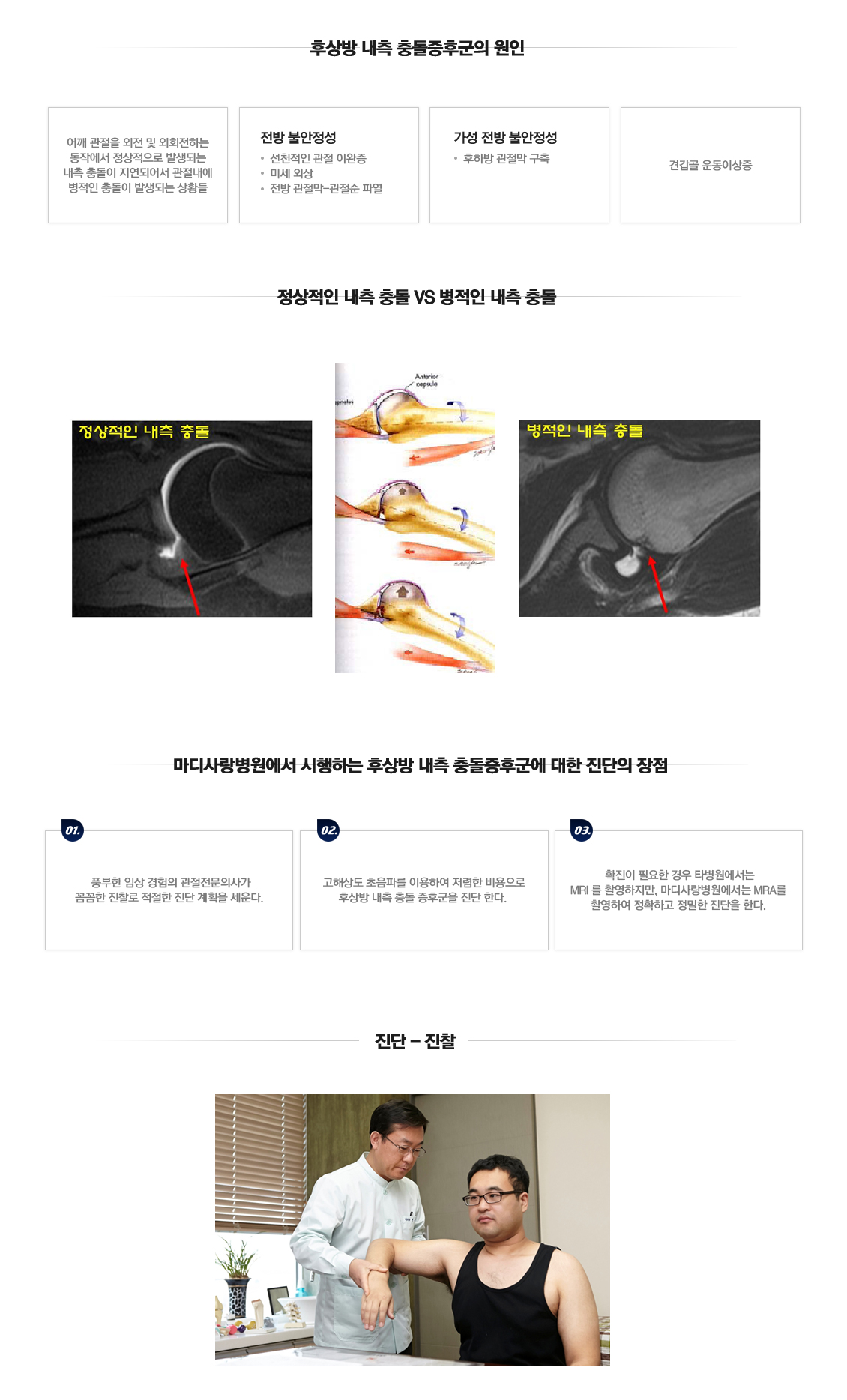 후상방내측Impingement syndrome 