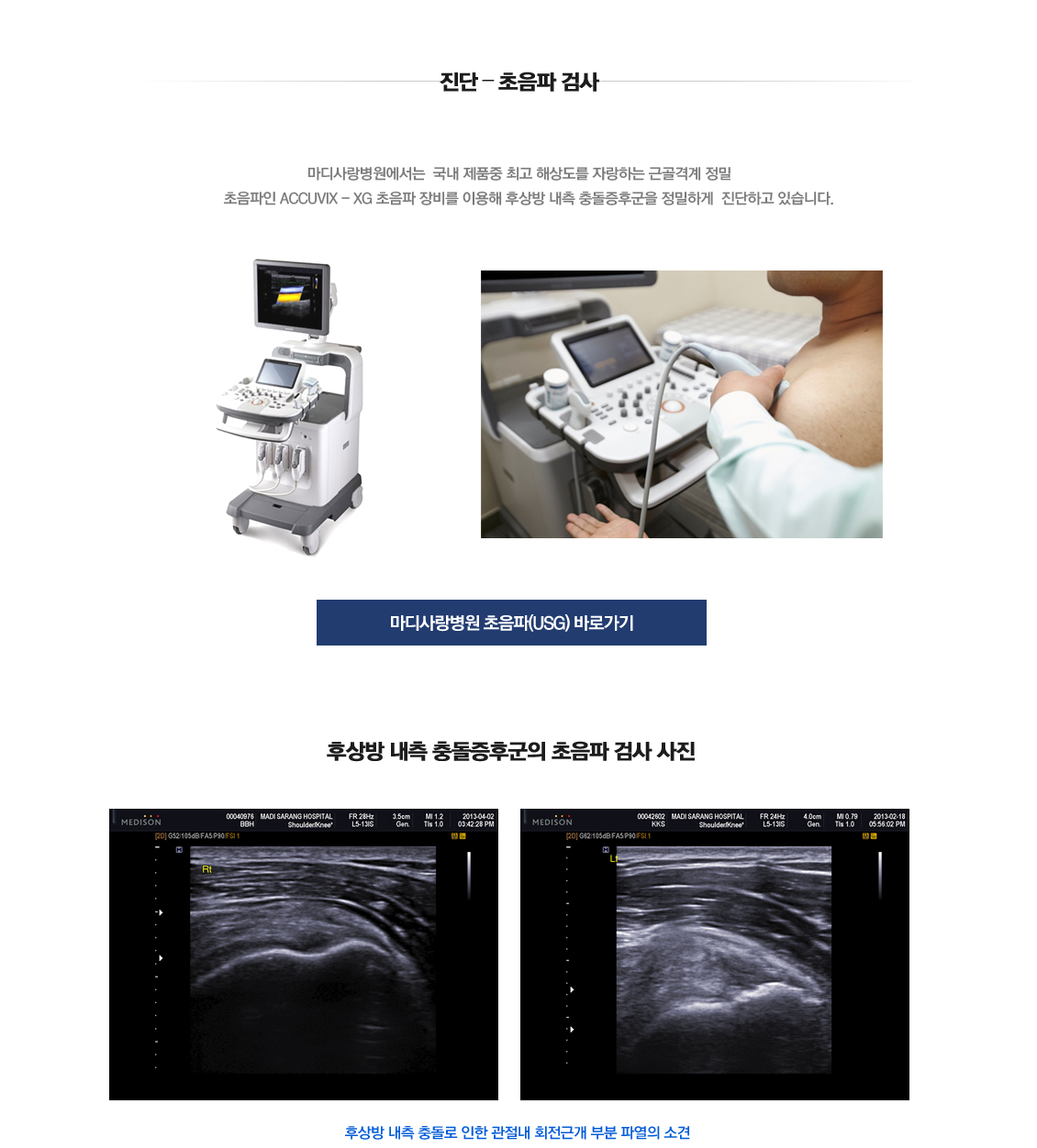 후상방내측Impingement syndrome 