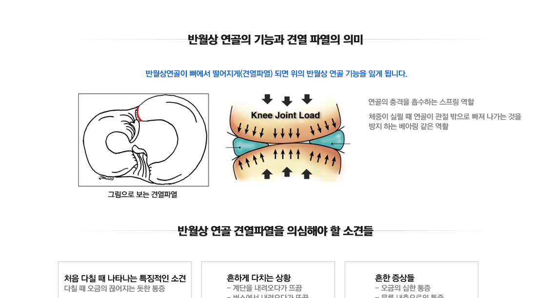 Meniscus Root Tears