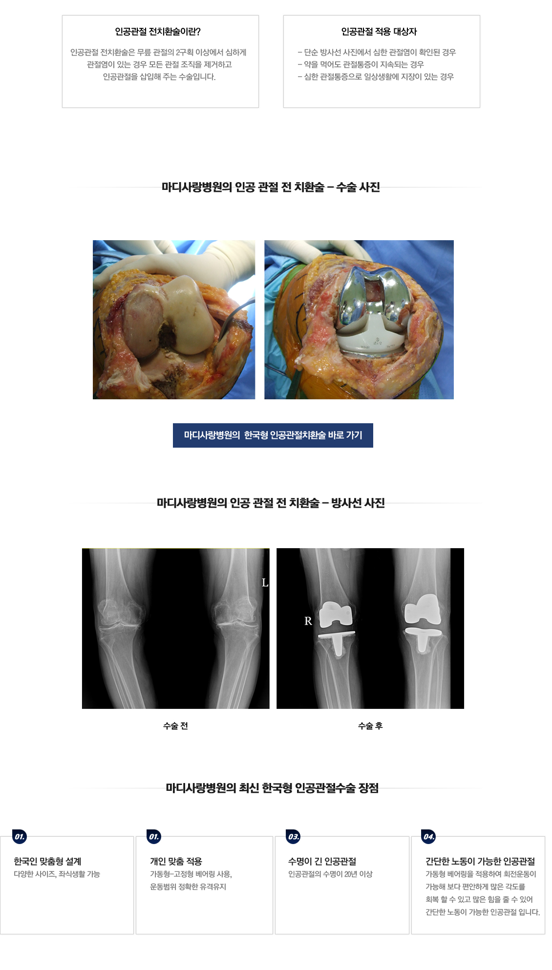 Osteoarthritis