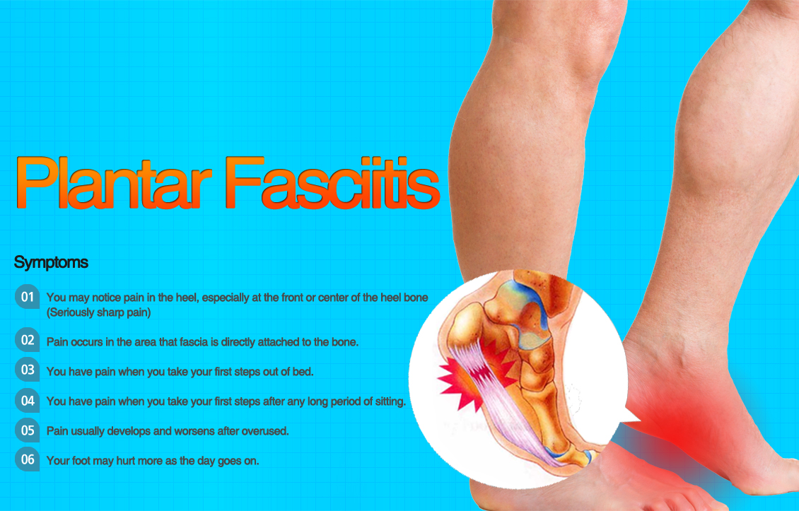 Plantar Fasciitis