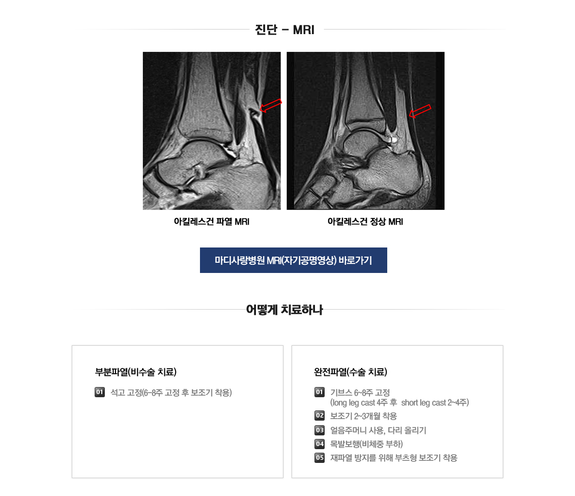 Achilles Tendon Injury