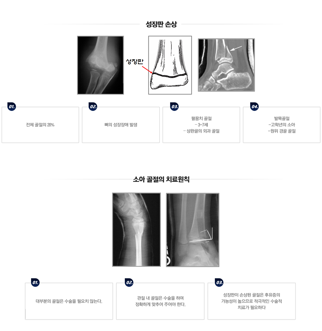 손목 관절 골절