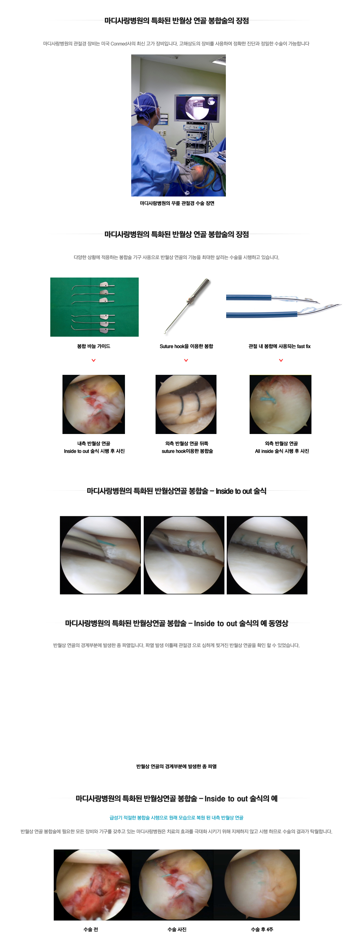 어깨 골절수술