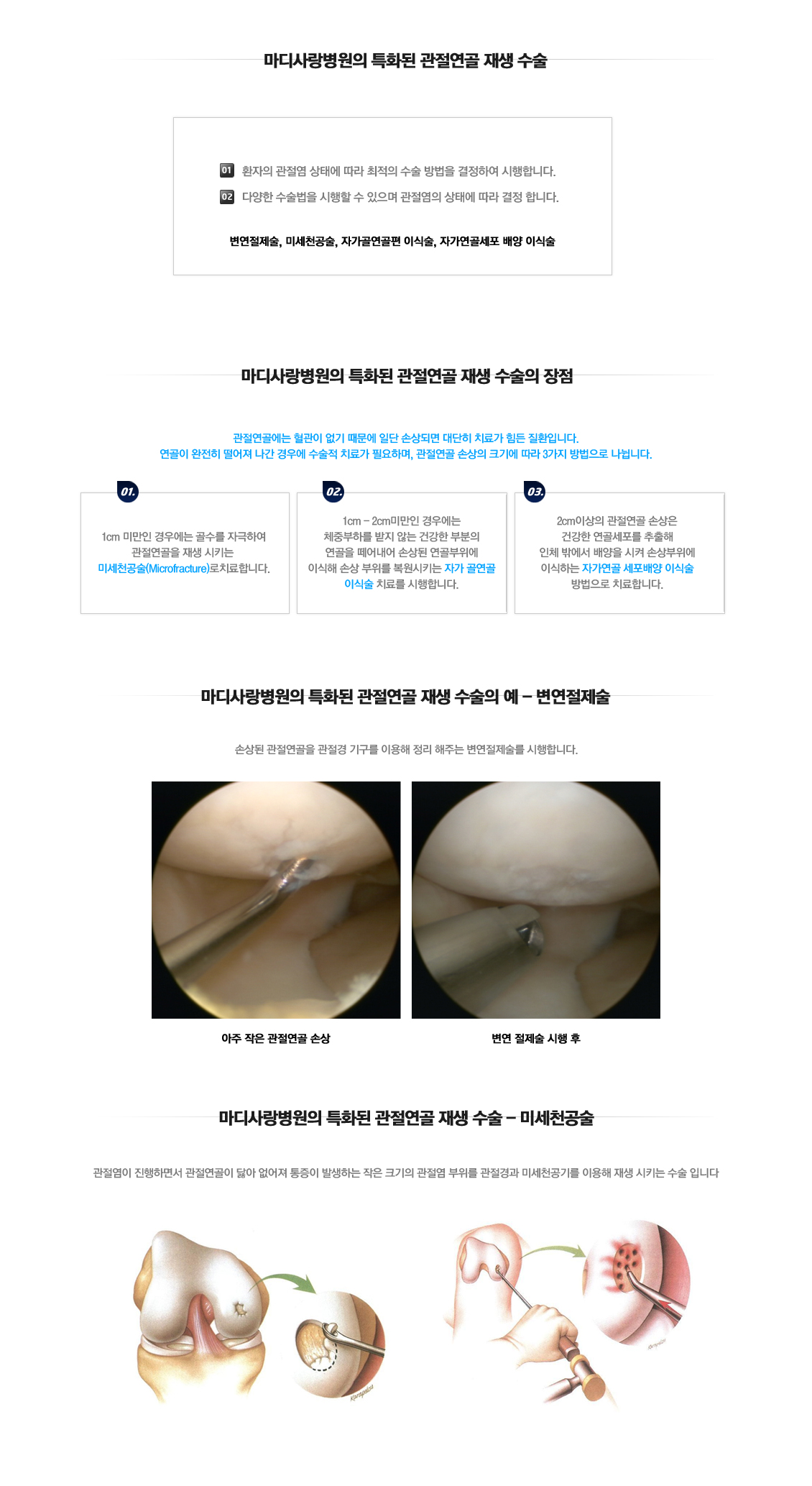 Articular Cartilage Regeneration