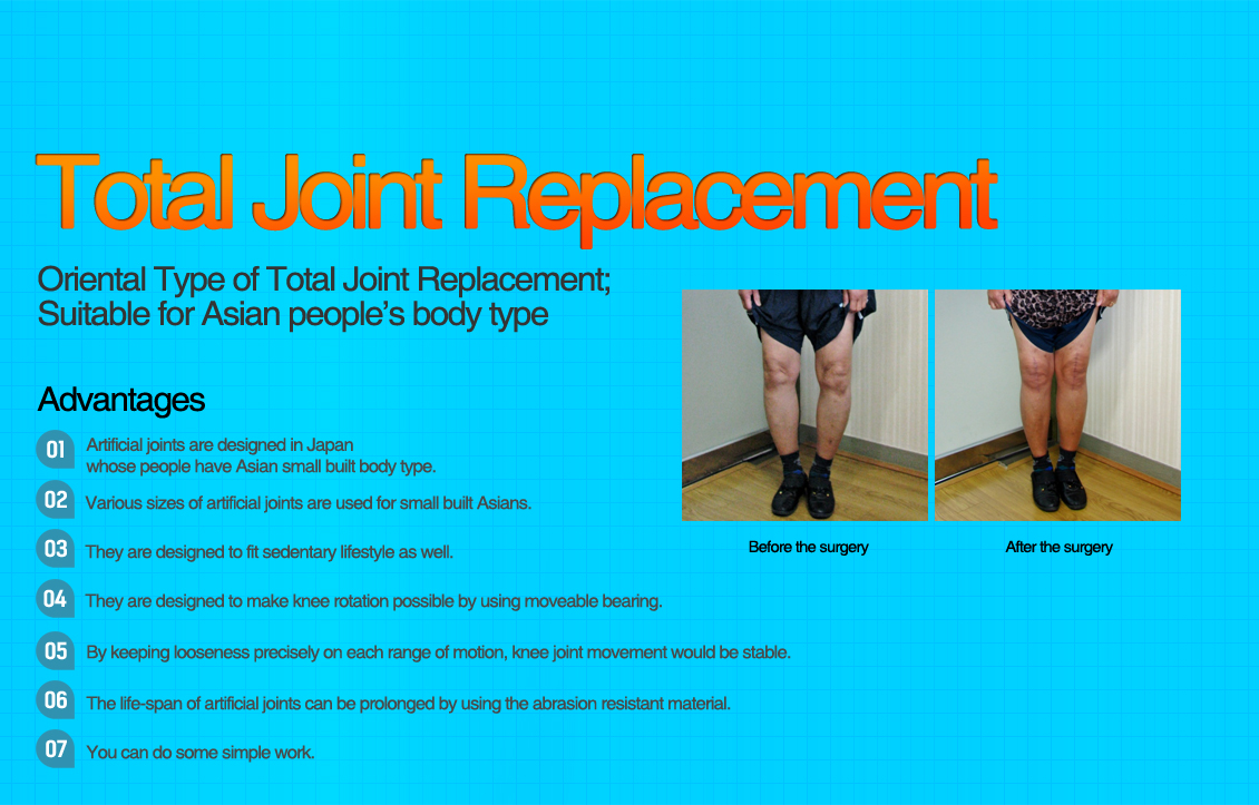 Total Joint Arthroplasty