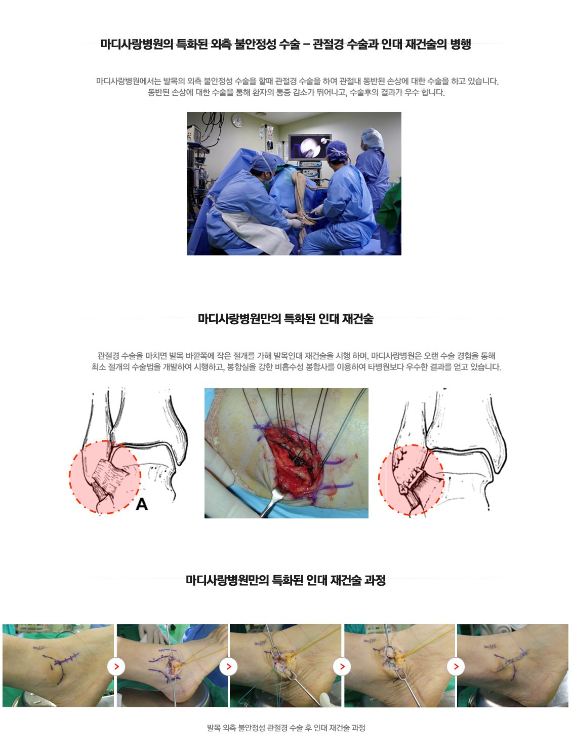 Lateral Ankle Instability Surgery