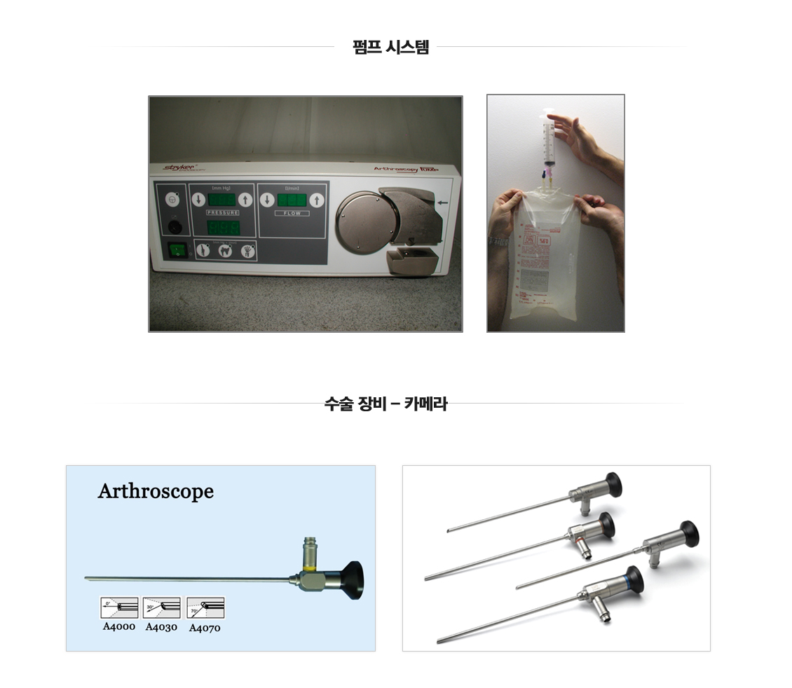 Arthroscopic Surgery