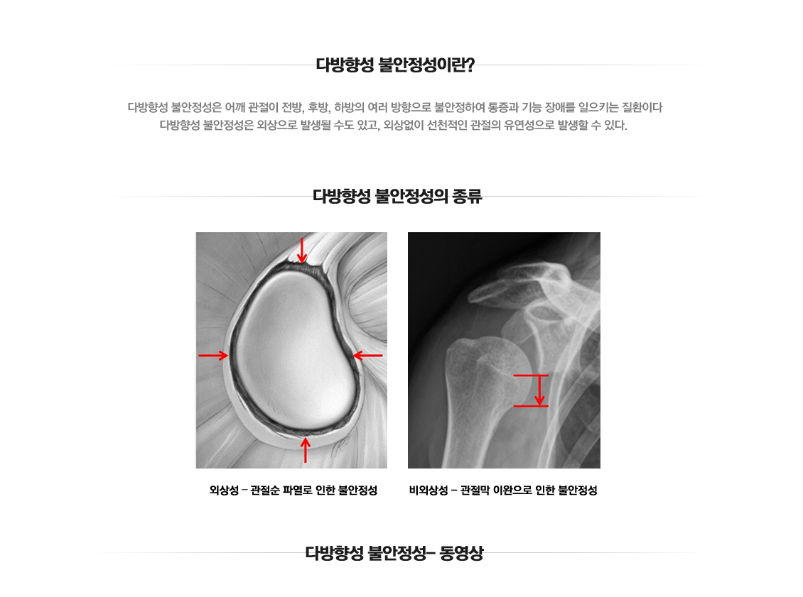 다방향성 불안정성