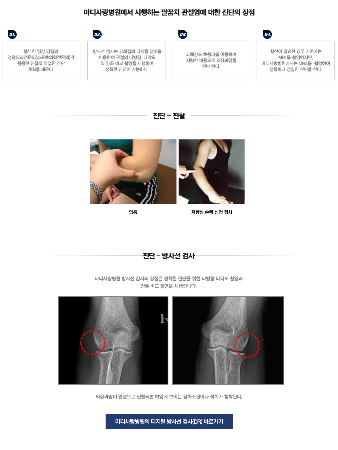 팔꿈치 증상별 진단 