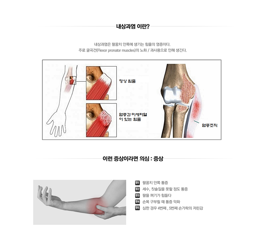 팔꿈치 증상별 진단 