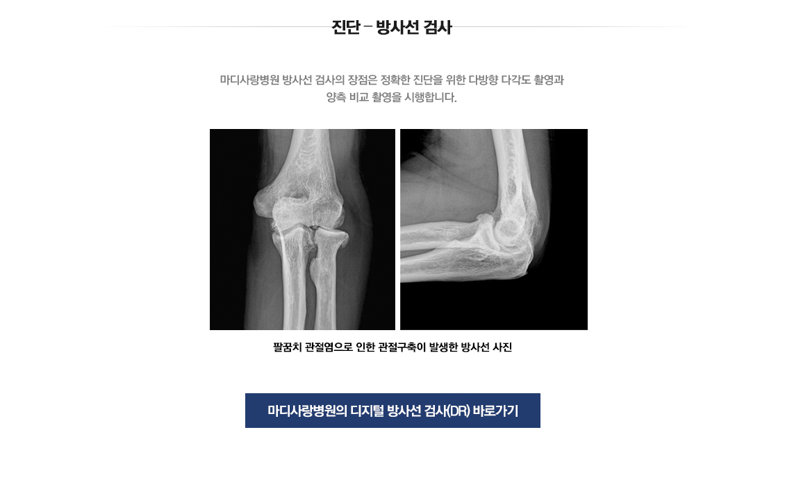 팔꿈치 증상별 진단 