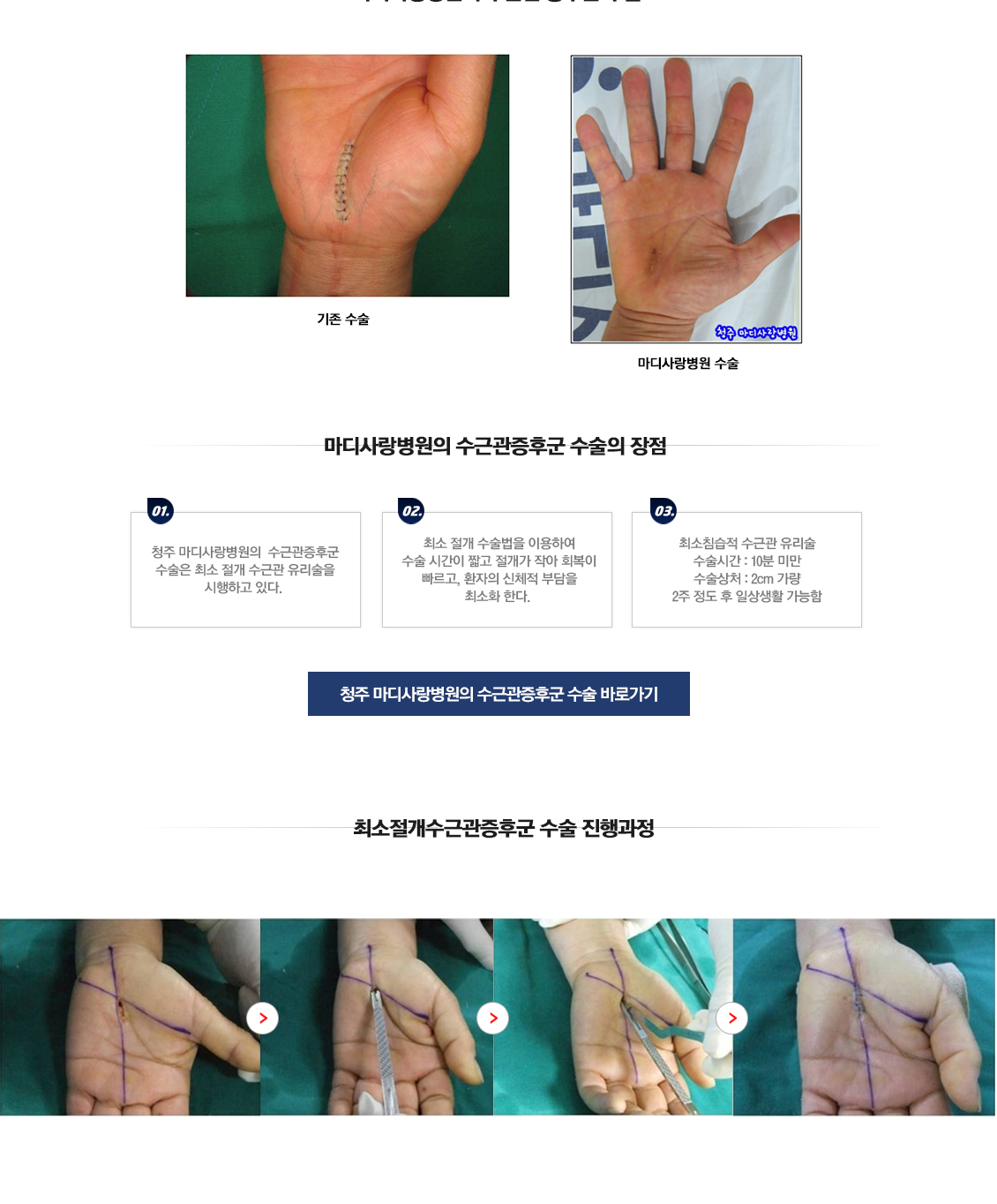 손목 증상별 진단 