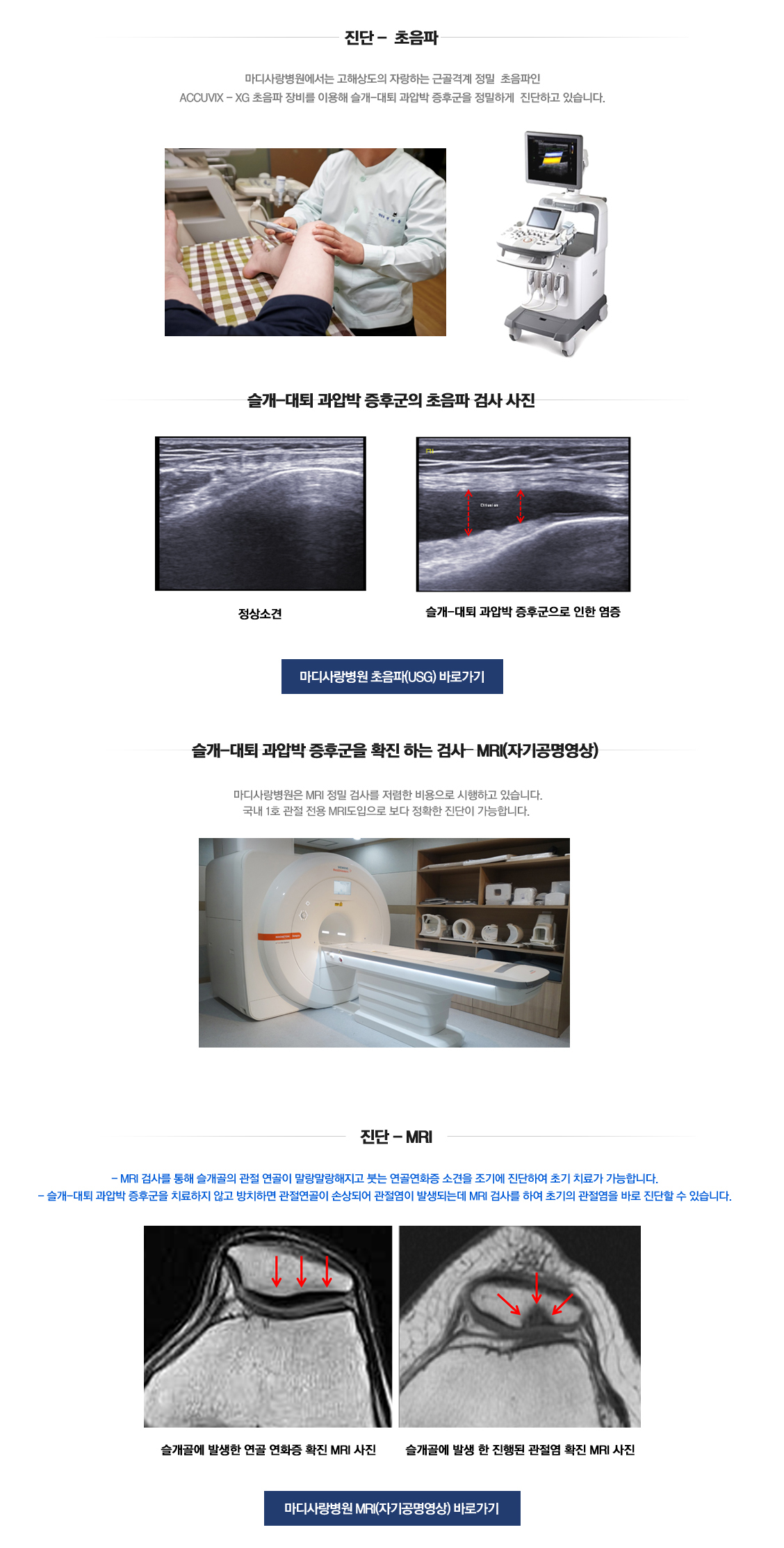 슬개대퇴과압박 증후군