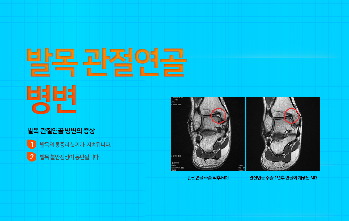 발목 증상별 진단