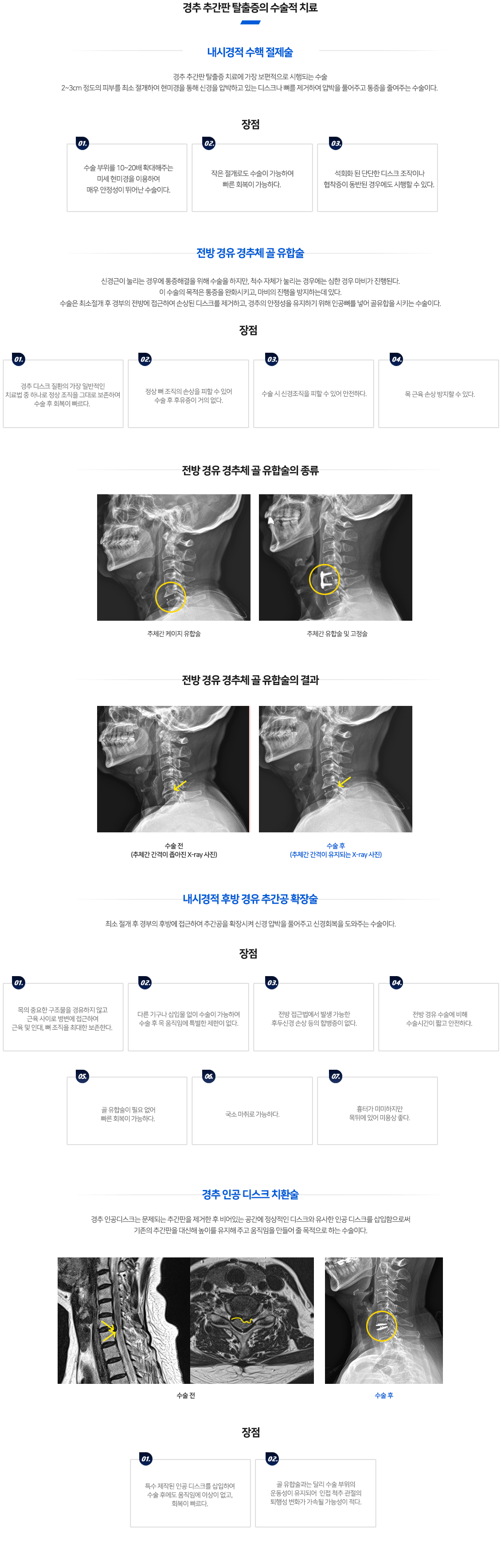 경추추간판탈출증