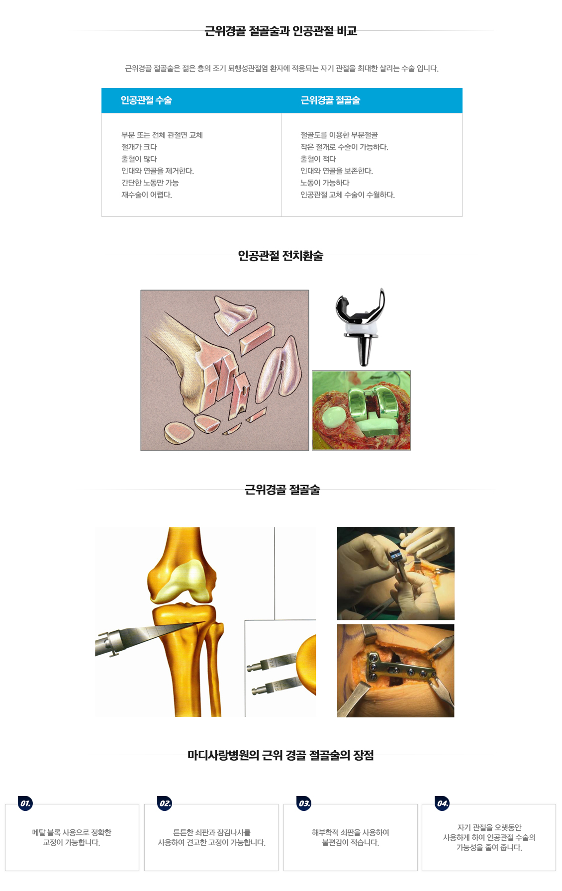 근위경골 절골술