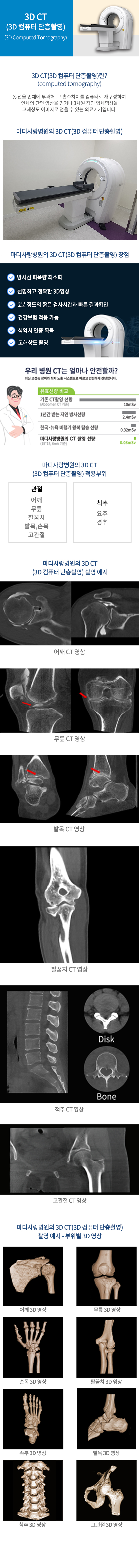 컴퓨터 단층촬영(3D CT)