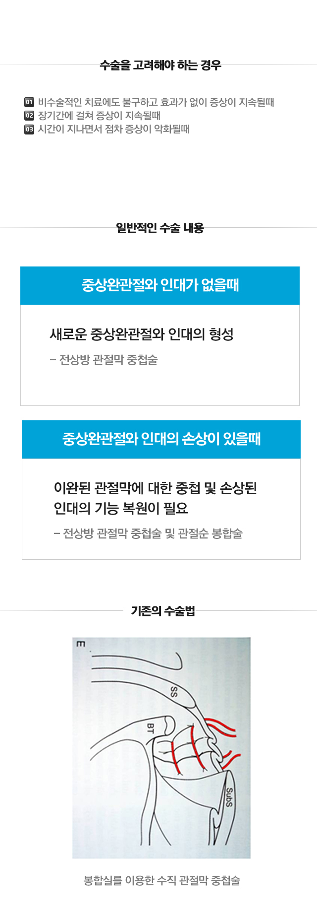 전상방 내측충돌증후군