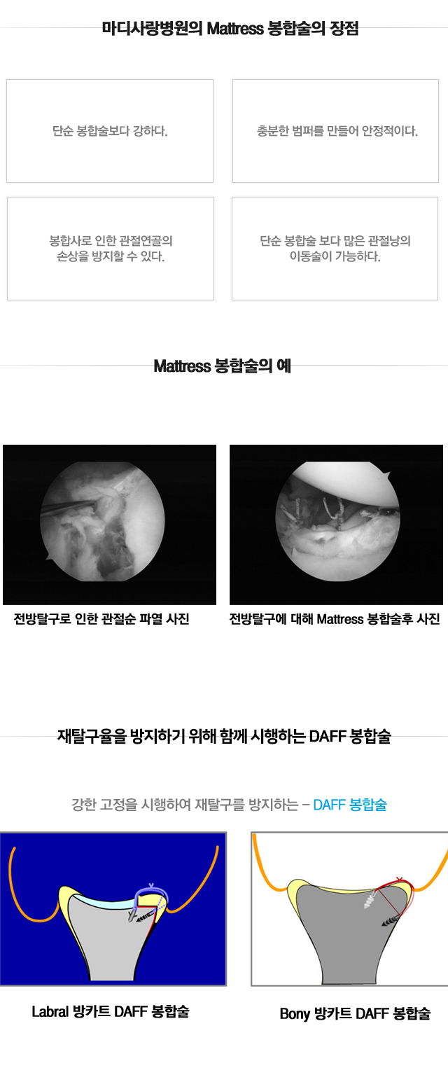 외상성탈구