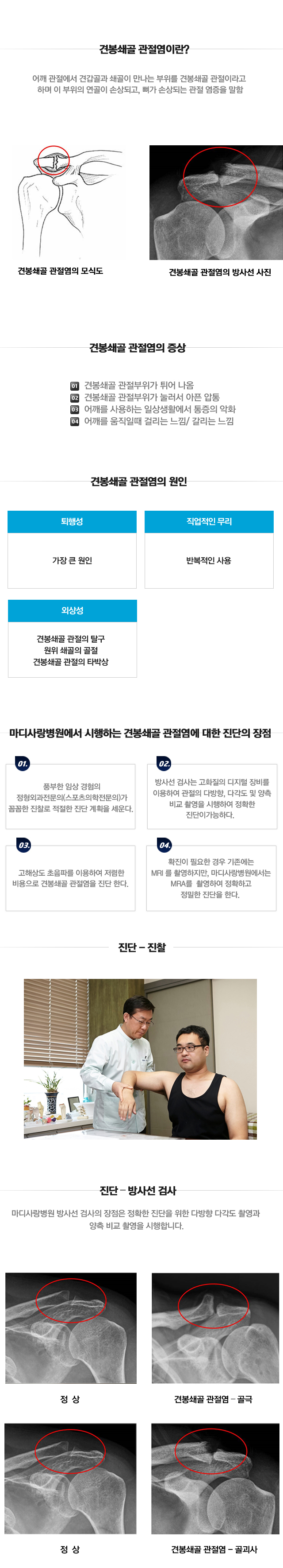 견봉쇄골 관절염