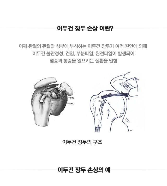 이두건 장두 손상