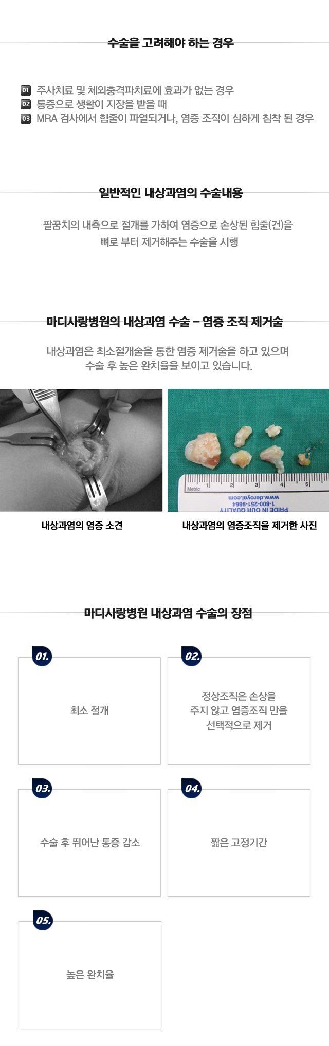 내상과염