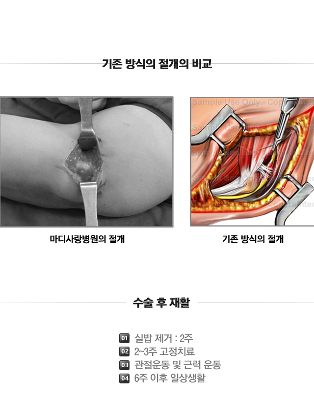 내상과염