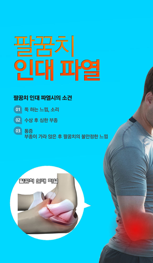 팔꿈치인대파열