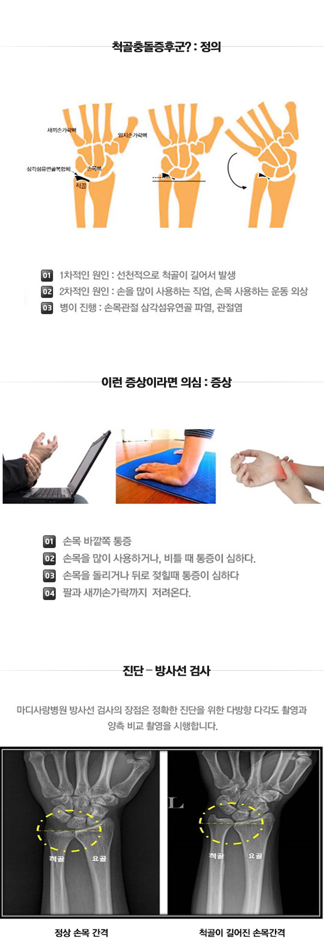 척골충돌증후군