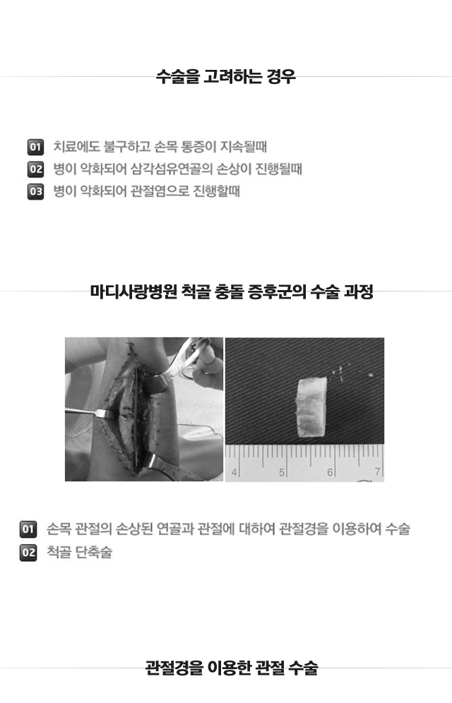 척골충돌증후군