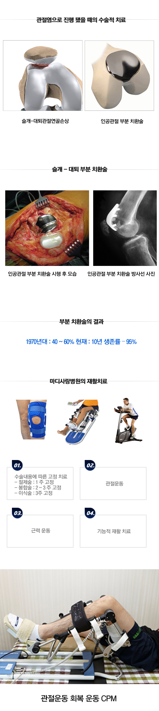 슬개대퇴과압박 증후군