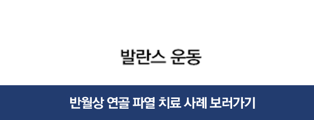 반월상연골파열