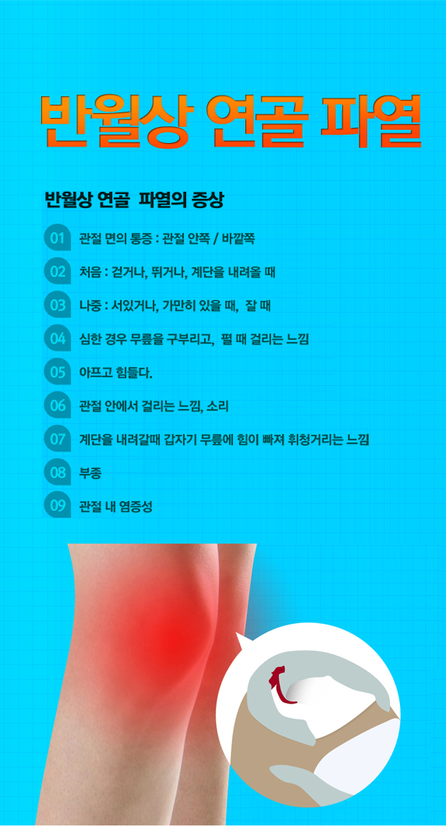 반월상연골파열