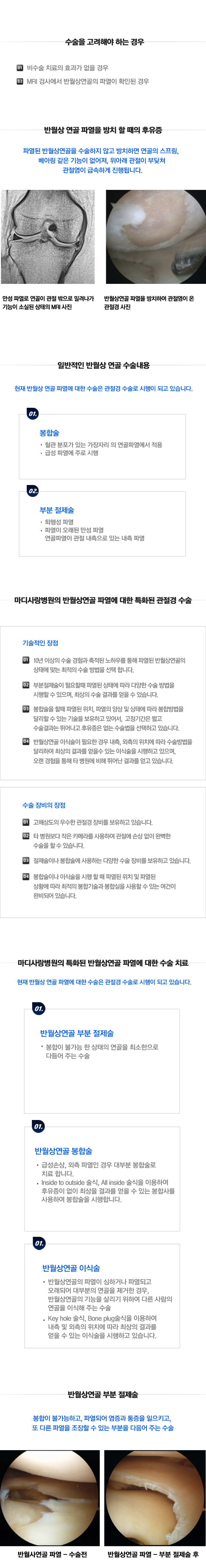 반월상연골파열