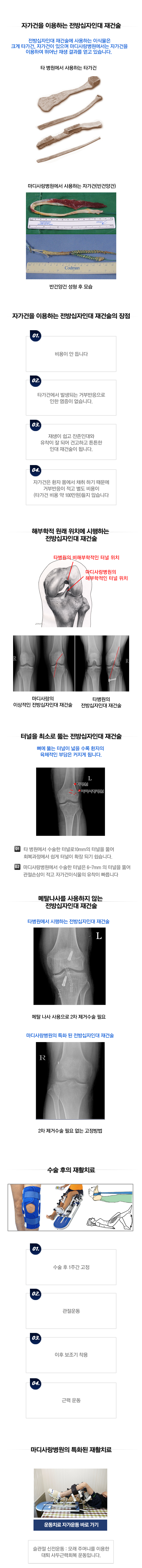 전방십자인대 파열