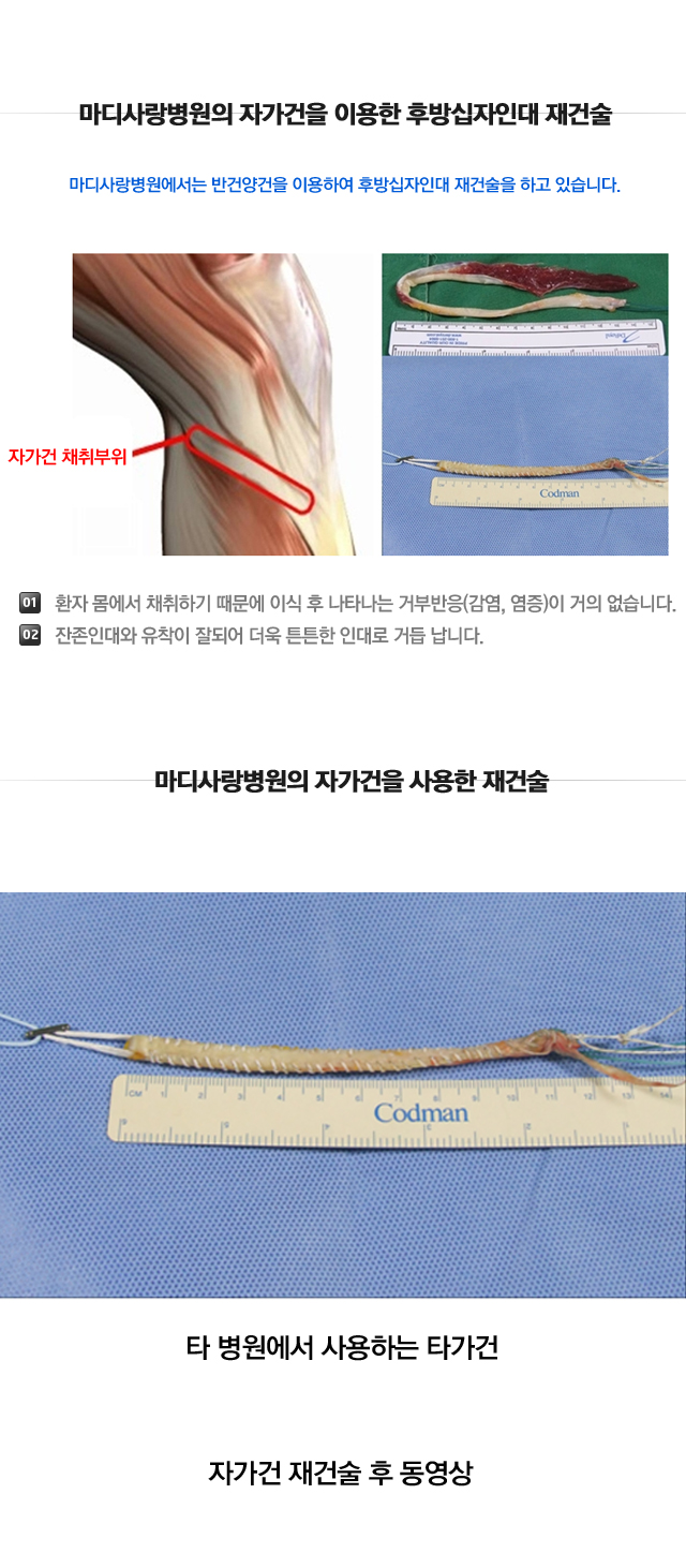 후방십자인대파열