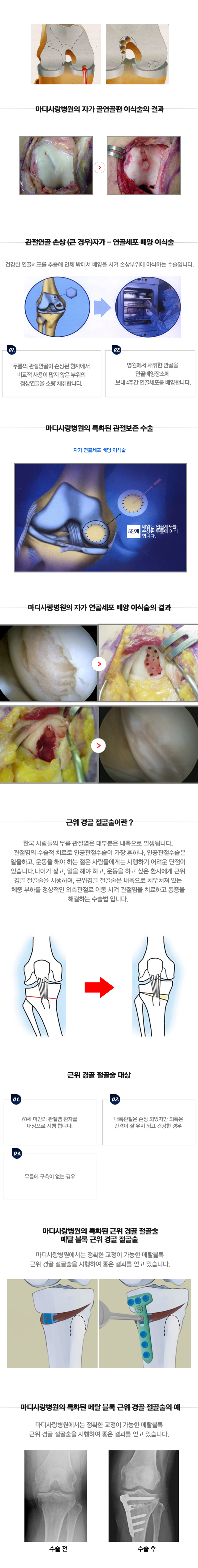 퇴행성관절염