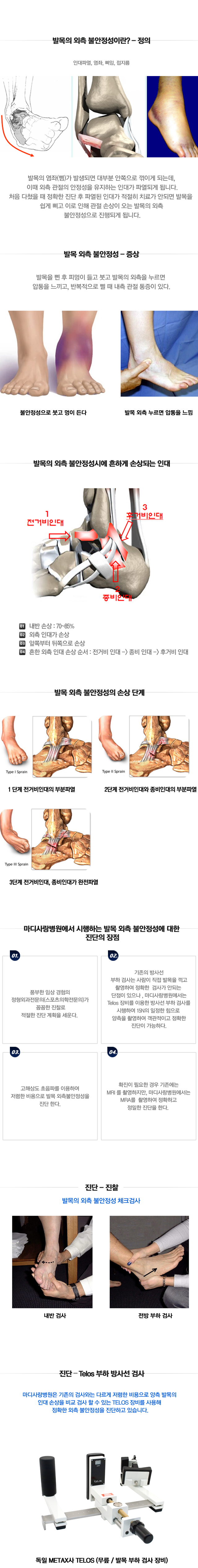 외측 불안정성